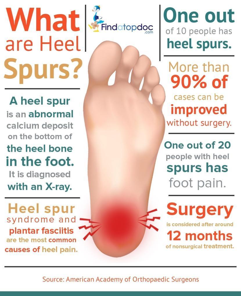 What Is Heel Spurs? Causes, Symptoms & Treatment Options – BodyHeal